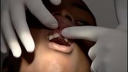 Imagem Trauma dentário: o que fazer quando o dente quebra ou cai?